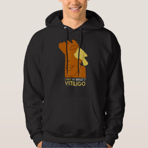 Vitiligo Awareness I Have Vitiligo So What Hoodie