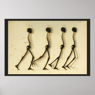Walking Gait Analysis Leg Spine Chiropractic Chart