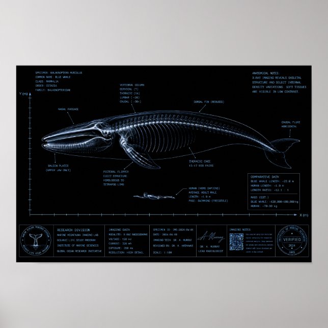 Whale vs Human Size Comparison X-Ray Poster (Front)