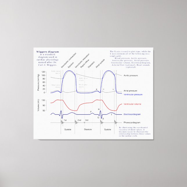 Wiggers Diagram Canvas Print (Front)