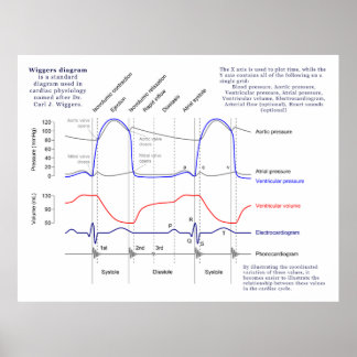 Wiggers Diagram Poster