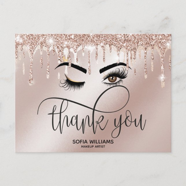 Wink Beautiful Brown Eye with Gold Crown  Postcard (Front)