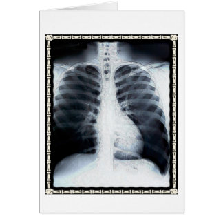 X-Ray Chest