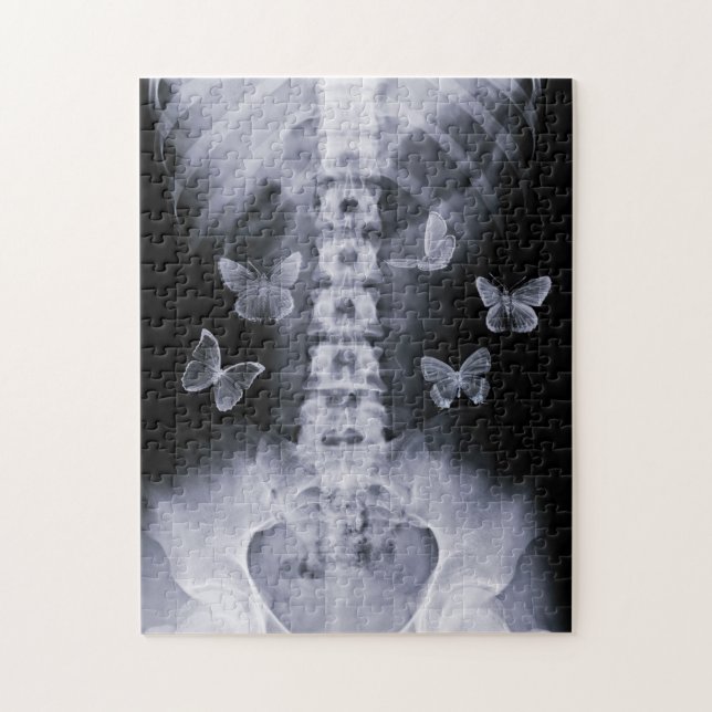 X-Ray Conceptual Butterflies Puzzle (Vertical)