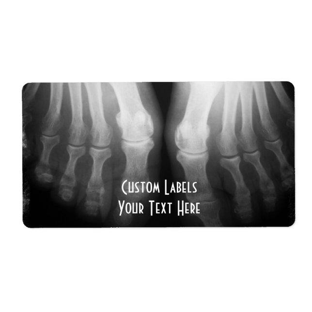 X-Ray Feet Human Skeleton Bones Black & White (Front)