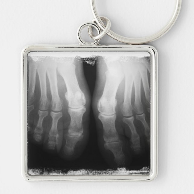 X-Ray Feet Human Skeleton Bones Black & White Key Ring (Front)