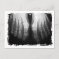 X-Ray Feet Human Skeleton Bones Black & White