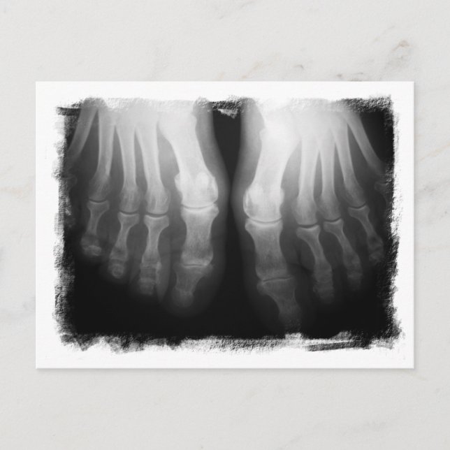 X-Ray Feet Human Skeleton Bones Black & White Postcard (Front)