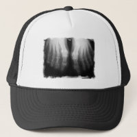 X-Ray Feet Human Skeleton Bones Black & White