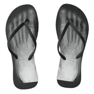 X-Ray Feet! Jandals