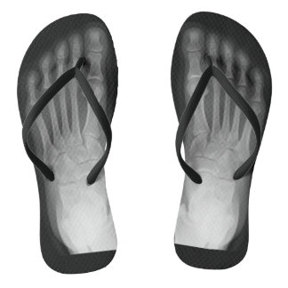 X-Ray Feet! Jandals