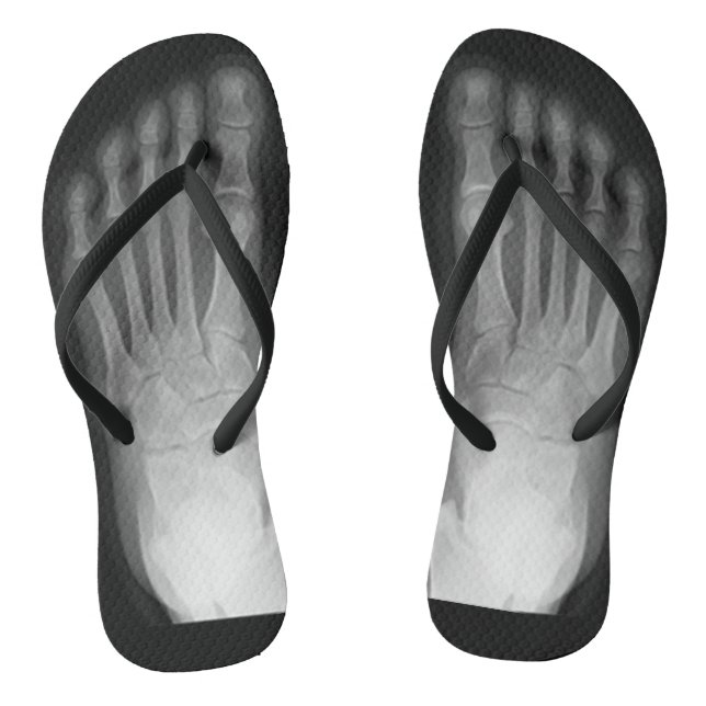 X-Ray Feet! Jandals (Footbed)