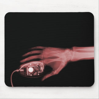 X-Ray Hand & Computer Mouse Pad
