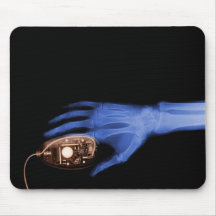 X-Ray Hand & Computer Mouse