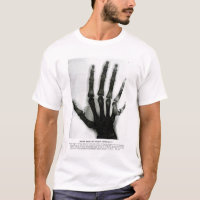 X-Ray Hand with Extra Finger Shirt