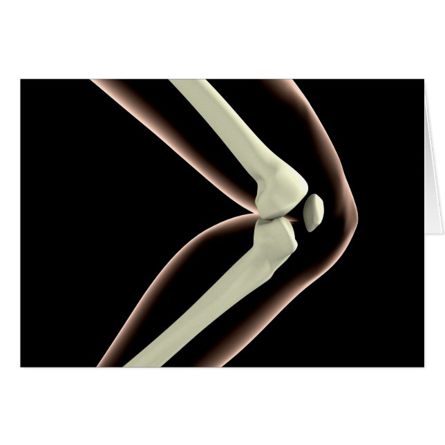 X-Ray Image Of Knee 1 (Front Horizontal)