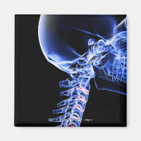X-ray image of the bones of the neck