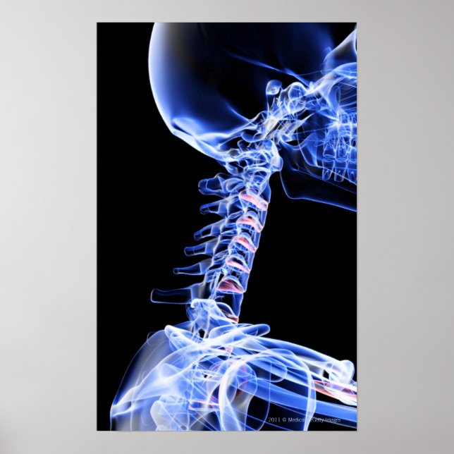 X-ray image of the bones of the neck poster (Front)