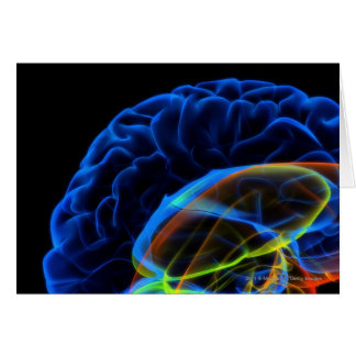 X-ray image of the brain