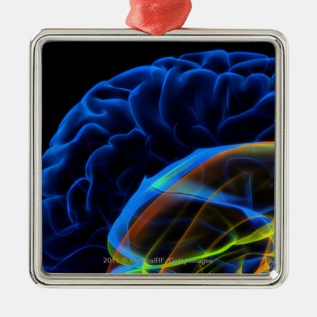X-ray image of the brain metal tree decoration (Front)