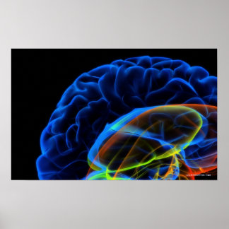 X-ray image of the brain poster
