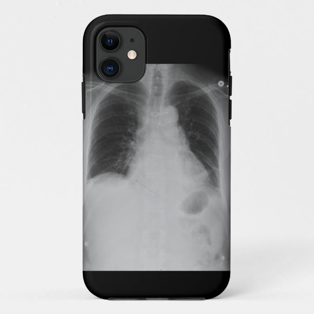 X Ray ~ iPhone 5 CaseMate case (Back)