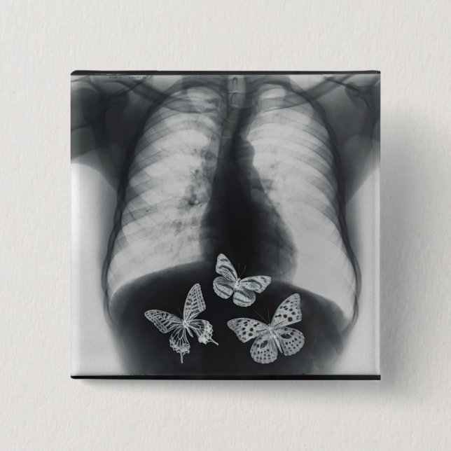 X-ray of butterflies in the stomach 15 cm square badge (Front)
