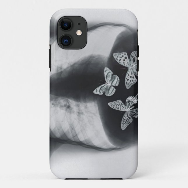 X-ray of butterflies in the stomach Case-Mate iPhone case (Back)