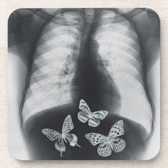 X-ray of butterflies in the stomach coaster (Front)