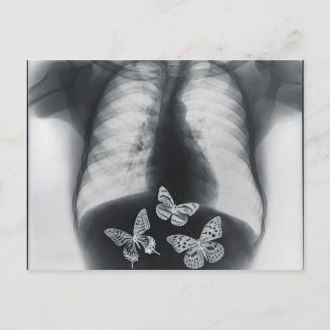 X-ray of butterflies in the stomach postcard (Front)