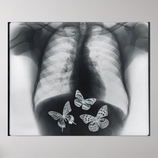 X-ray of butterflies in the stomach poster (Front)