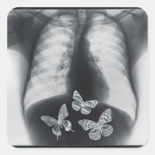 X-ray of butterflies in the stomach square sticker