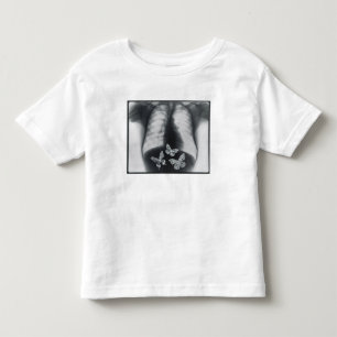X-ray of butterflies in the stomach toddler T-Shirt