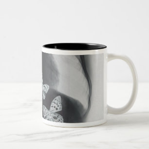 X-ray of butterflies in the stomach Two-Tone coffee mug