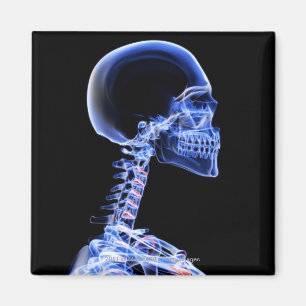 X-ray of the bones in the neck magnet