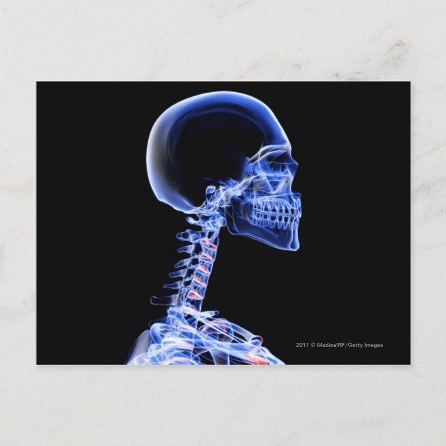 X-ray of the bones in the neck postcard (Front)