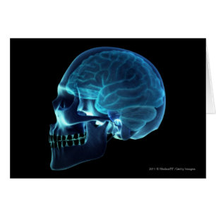 X-ray of the brain inside a skull