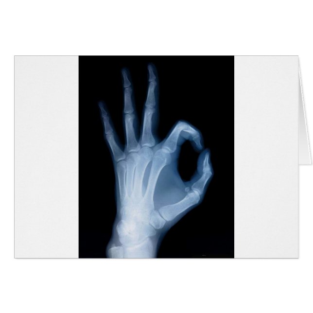 x ray ok (Front Horizontal)