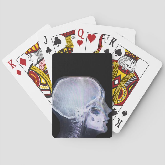 X-Ray Playing Cards (Back)