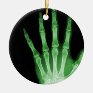 X-RAY SKELETON HAND FINGERS GREEN CERAMIC TREE DECORATION