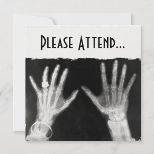 X-Ray Skeleton Hands & Jewellery - B&W