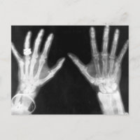 X-Ray Skeleton Hands & Jewellery - B&W