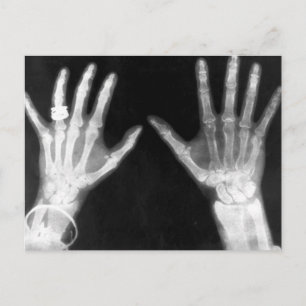 X-Ray Skeleton Hands & Jewellery - B&W Postcard