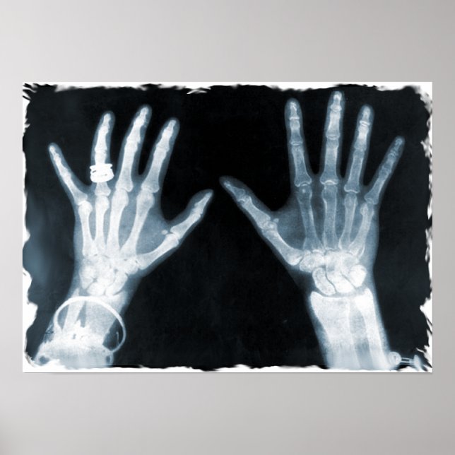 X-Ray Skeleton Hands & Jewellery - Blue Poster (Front)