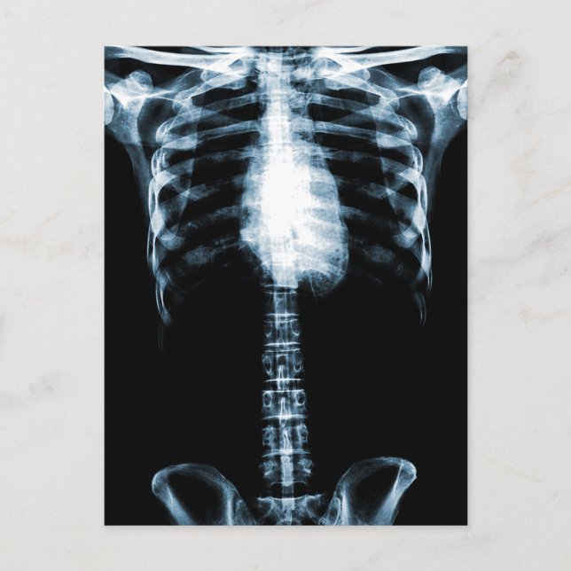 X-RAY SKELETON TORSO RIBS BLUE POSTCARD (Front)