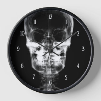 X-Ray Skull - B&W Clock