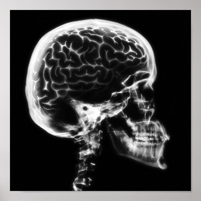 X-RAY SKULL BRAIN - BLACK & WHITE POSTER (Front)
