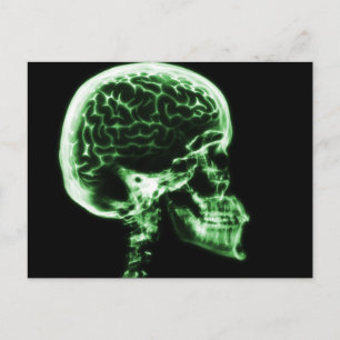 X-RAY SKULL BRAIN - GREEN POSTCARD