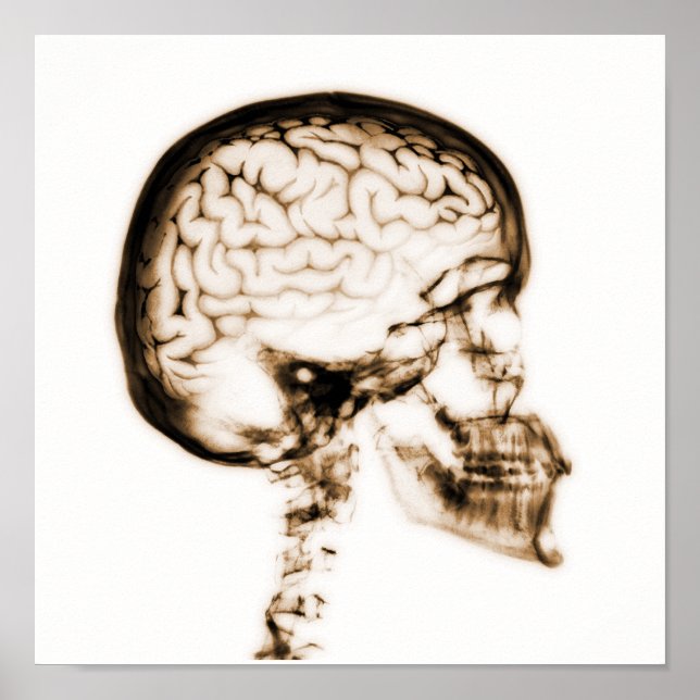 X-RAY SKULL BRAIN - ORANGE POSTER (Front)