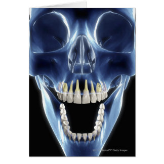 X-ray style look at human teeth